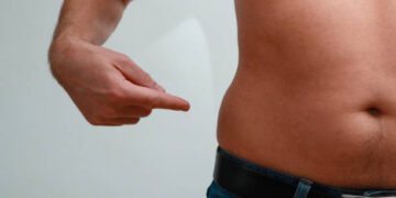 Überlegen Sie eine Fettabsaugung